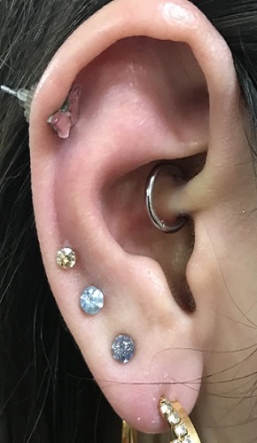 ピアスーサンライズ美容外科 ピアスーサンライズ美容外科